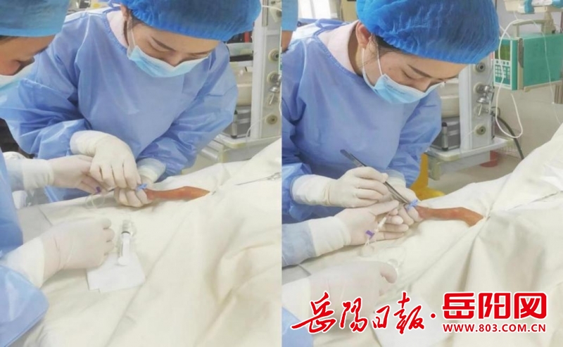 岳阳市中心医院新生儿科picc护理团队已完成新生儿picc置管术352例,为