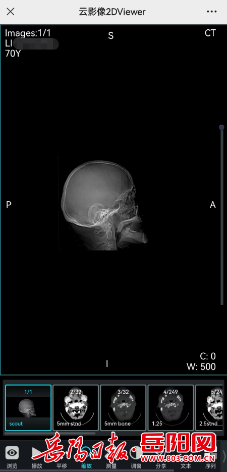 怎么自助取胶片医院市中心医院“云胶片”上线 影像报告扫码可见_https://www.jmylbn.com_新闻资讯_第4张